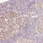 TREX2 Polyclonal Antibody