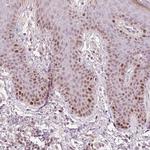 TREX2 Antibody in Immunohistochemistry (Paraffin) (IHC (P))