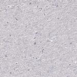 ZP3 Polyclonal Antibody