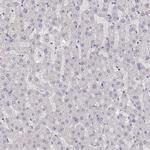 ZP3 Antibody in Immunohistochemistry (Paraffin) (IHC (P))