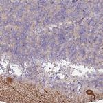 MTMR14 Polyclonal Antibody