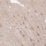 TM2D3 Antibody in Immunohistochemistry (Paraffin) (IHC (P))