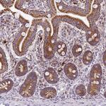 TM2D3 Antibody in Immunohistochemistry (Paraffin) (IHC (P))