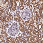 TM2D3 Antibody in Immunohistochemistry (Paraffin) (IHC (P))