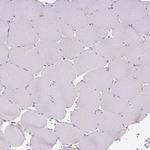 TM2D3 Antibody in Immunohistochemistry (Paraffin) (IHC (P))