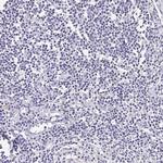 UGT1A6 Polyclonal Antibody