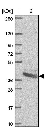 BCAT2 Antibody in Western Blot (WB)