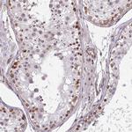 ZNF689 Antibody in Immunohistochemistry (IHC)