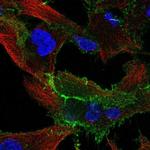 EPB41L1 Polyclonal Antibody