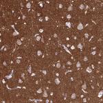 EPB41L1 Antibody in Immunohistochemistry (Paraffin) (IHC (P))