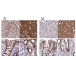 EPB41L1 Antibody in Immunohistochemistry (IHC)