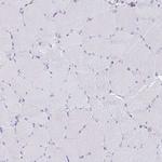 EPB41L1 Antibody in Immunohistochemistry (IHC)