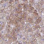 EPB41L1 Antibody in Immunohistochemistry (IHC)