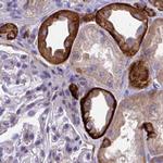 EPB41L1 Antibody in Immunohistochemistry (IHC)