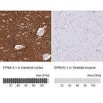 EPB41L1 Antibody