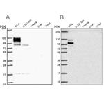 EPB41L1 Antibody in Western Blot (WB)