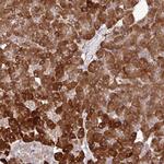 SAPAP4 Polyclonal Antibody