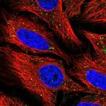 ZNF266 Polyclonal Antibody