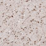 ZNF266 Antibody in Immunohistochemistry (Paraffin) (IHC (P))