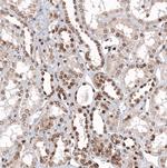 ZNF266 Antibody in Immunohistochemistry (Paraffin) (IHC (P))