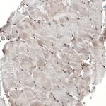 ZNF266 Antibody in Immunohistochemistry (Paraffin) (IHC (P))