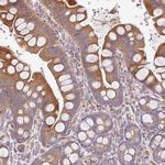 ZNF266 Antibody in Immunohistochemistry (IHC)