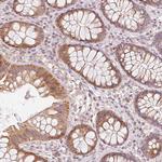 TOB2 Antibody in Immunohistochemistry (Paraffin) (IHC (P))