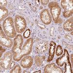 TOB2 Antibody in Immunohistochemistry (Paraffin) (IHC (P))