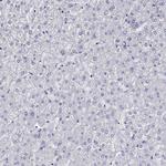 FER1L6 Antibody in Immunohistochemistry (Paraffin) (IHC (P))
