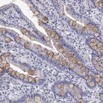 FER1L6 Antibody in Immunohistochemistry (Paraffin) (IHC (P))