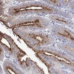 FER1L6 Antibody in Immunohistochemistry (Paraffin) (IHC (P))