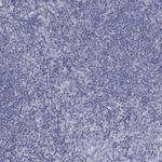 FER1L6 Antibody in Immunohistochemistry (Paraffin) (IHC (P))