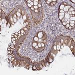 RNF144B Polyclonal Antibody