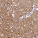 PPFIA4 Polyclonal Antibody