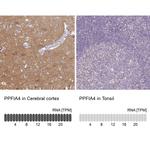PPFIA4 Antibody in Immunohistochemistry (IHC)
