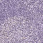 PPFIA4 Antibody in Immunohistochemistry (IHC)