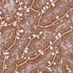 MRPL16 Antibody in Immunohistochemistry (Paraffin) (IHC (P))