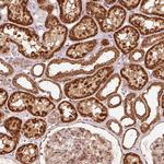 MRPL16 Antibody in Immunohistochemistry (Paraffin) (IHC (P))
