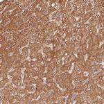 MRPL16 Antibody in Immunohistochemistry (Paraffin) (IHC (P))