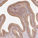 RAB35 Polyclonal Antibody