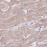 CAP2 Antibody in Immunohistochemistry (IHC)