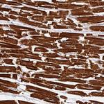 NT5C1A Polyclonal Antibody