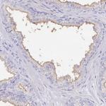 SLC44A4 Antibody in Immunohistochemistry (IHC)