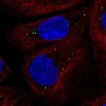 CCDC93 Polyclonal Antibody