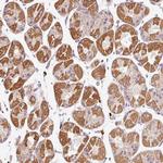 PNPLA5 Antibody in Immunohistochemistry (Paraffin) (IHC (P))
