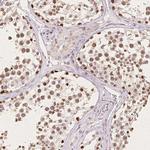 CCDC138 Antibody in Immunohistochemistry (Paraffin) (IHC (P))