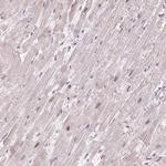 CCDC138 Antibody in Immunohistochemistry (IHC)