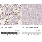 CCDC138 Antibody