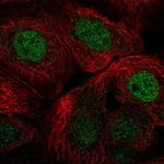 RCOR1 Polyclonal Antibody