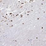 RCOR1 Antibody in Immunohistochemistry (Paraffin) (IHC (P))